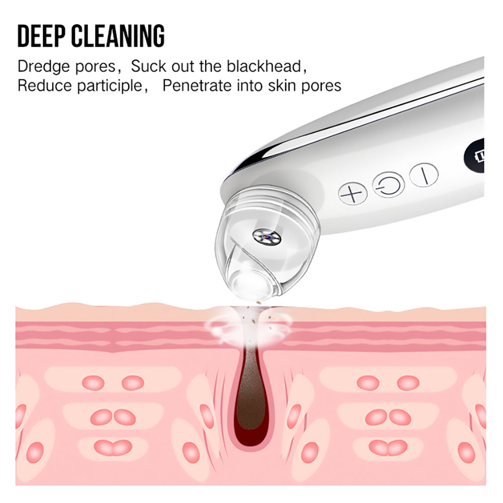 PoreNova Extractor - Facial Blackhead Remover